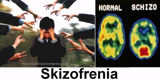skizofrenia