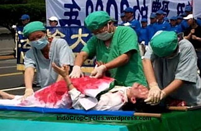 Transplantasi Organ di Cina 07