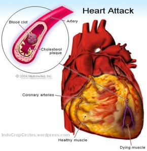 How-we-prevent-from-Heart-attack-Diseases