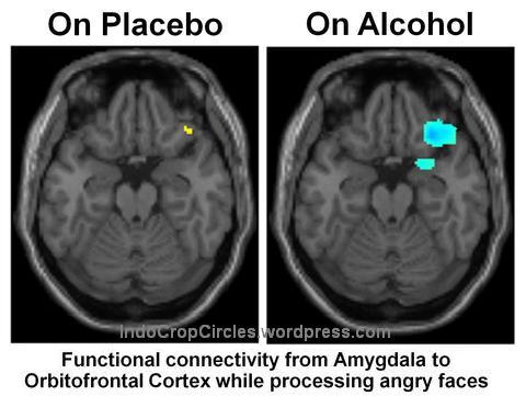 otak brains placebo