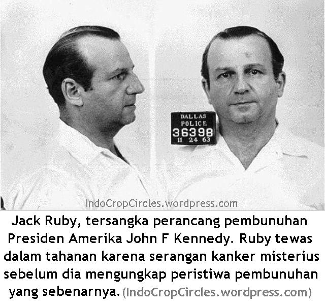 jack ruby tersangka pembunuh John F Kennedy