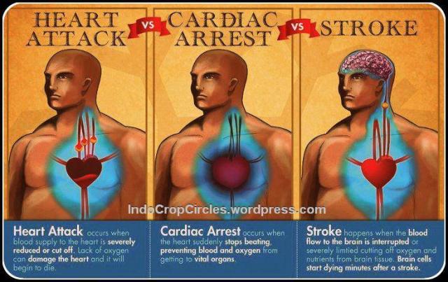 heart-attack-vs-cardiac-arrest-vs-stroke