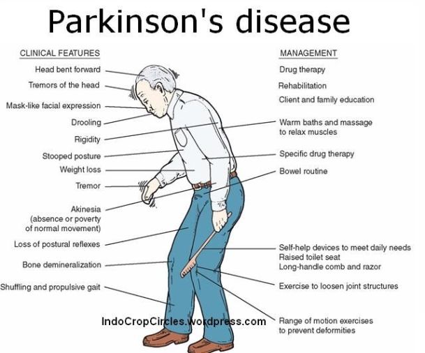 Parkinsons