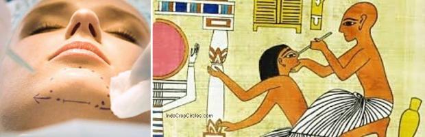 Bedah plastik atau cometic-surgery pada masa kini (kiri) dan pada masa Mesir kuno (kanan)